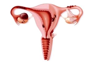 репродуктивный женский орган в разрезе картинка