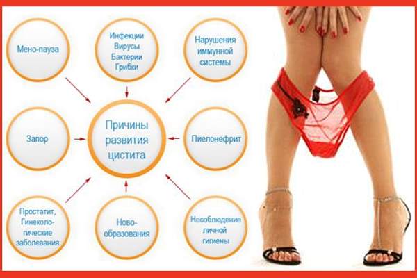 Менопауза и цистит: мочевой пузырь при климаксе у женщин