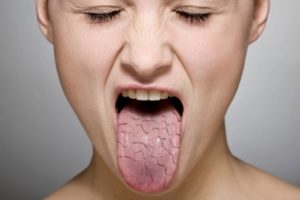 Препараты от сухости во рту при климаксе