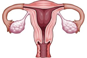 Почему увеличен яичник при менопаузе